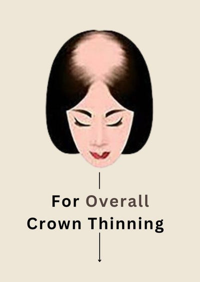 For Overall Hair Crown Thinning - 5X5" Silk Topper