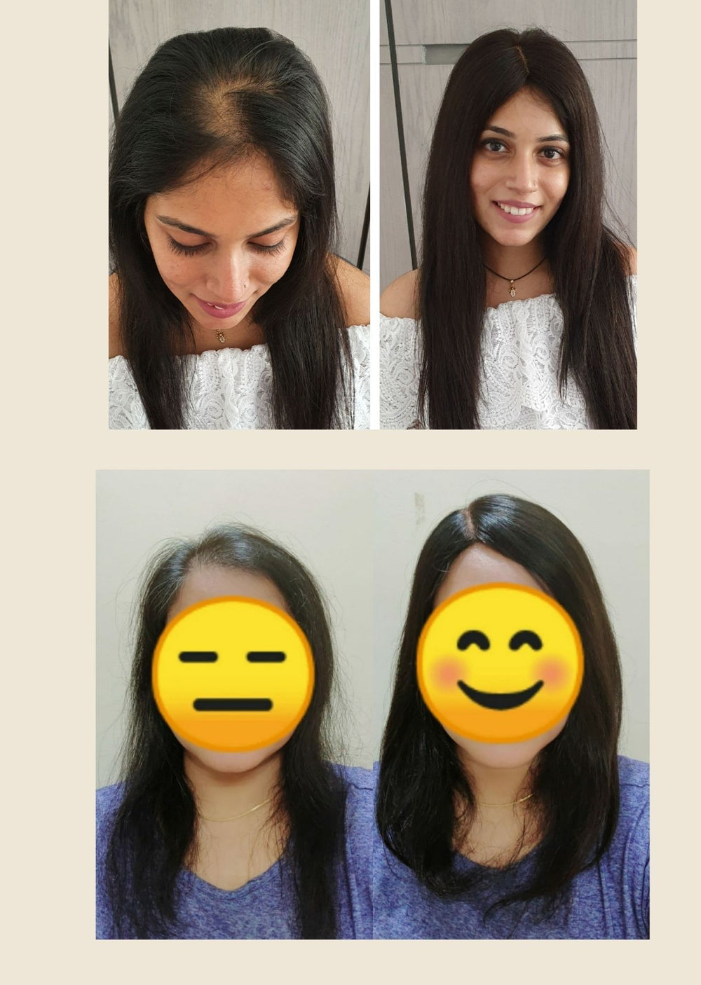 Customer before and after using 3 X 4" Silk Hair Topper