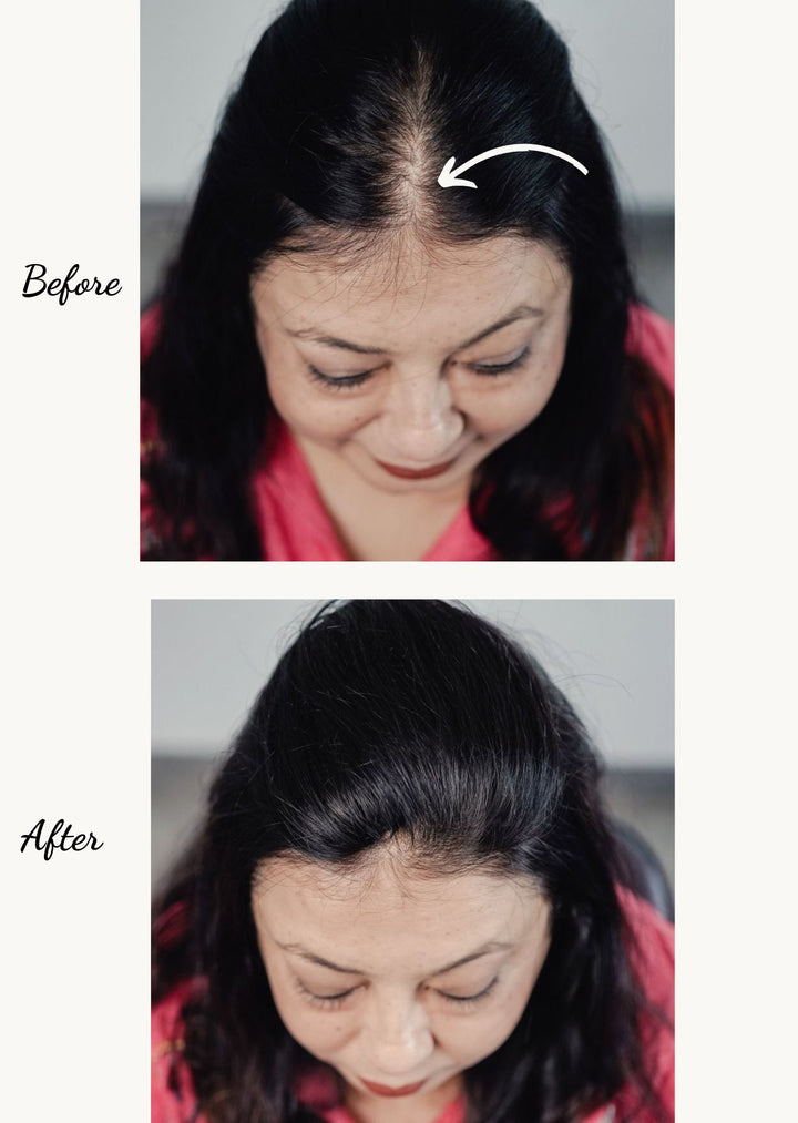 Cover-up Hair Patch