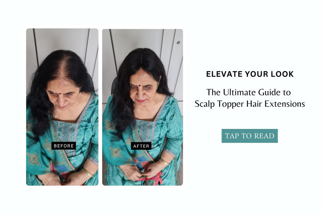 Elevate Your Look: The Ultimate Guide to Scalp Topper Hair Extensions