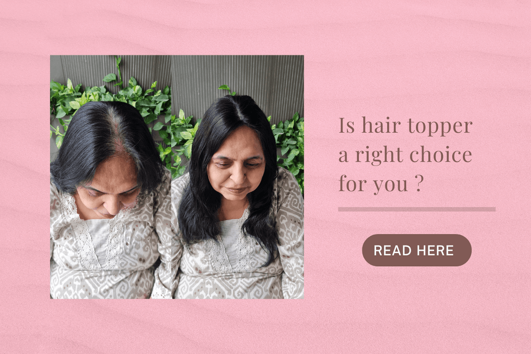 Is a hair patch the right choice for you?