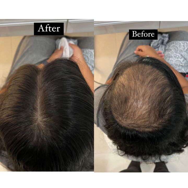 5 X 5" Clipless Topper