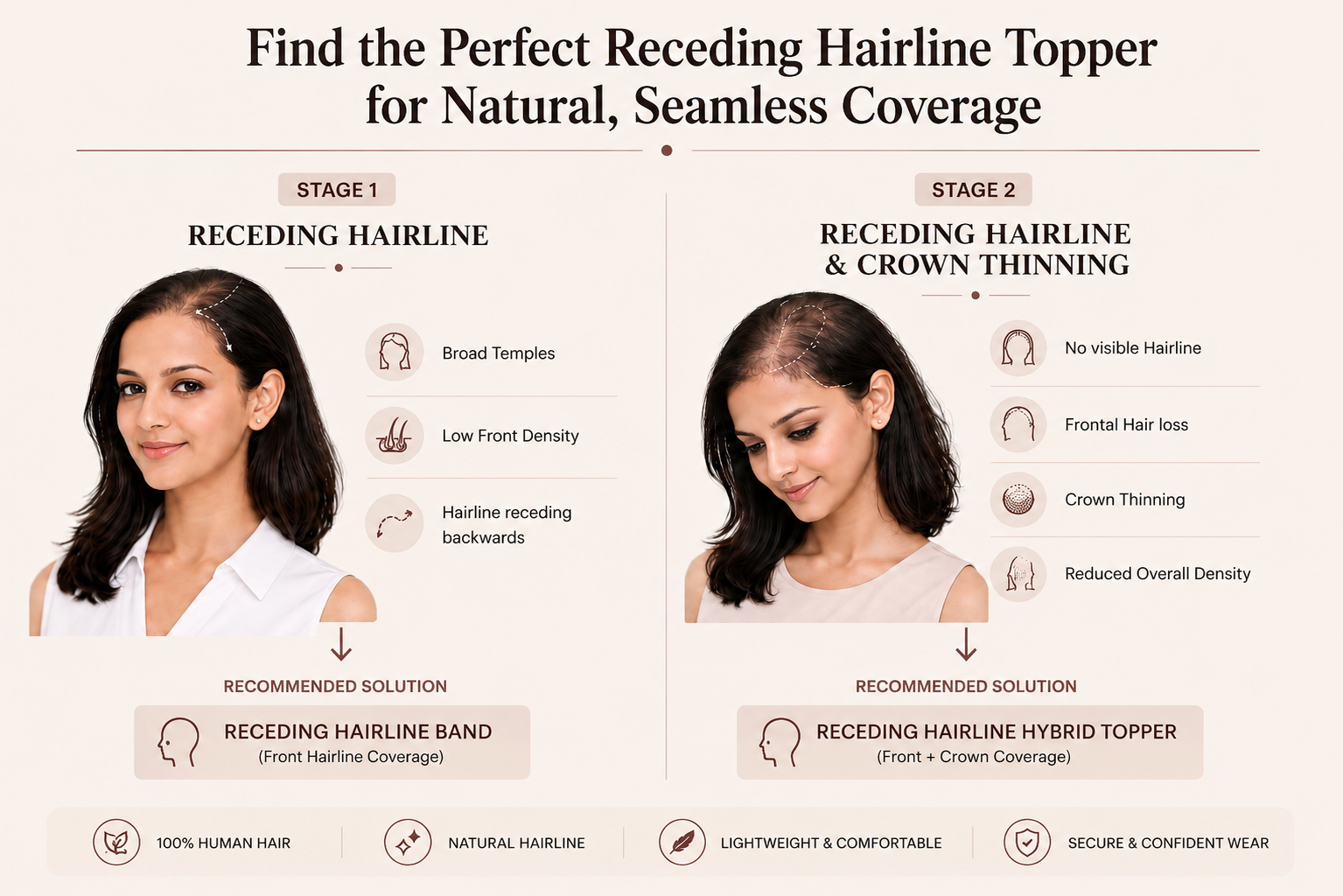 Receding Hairline Toppers