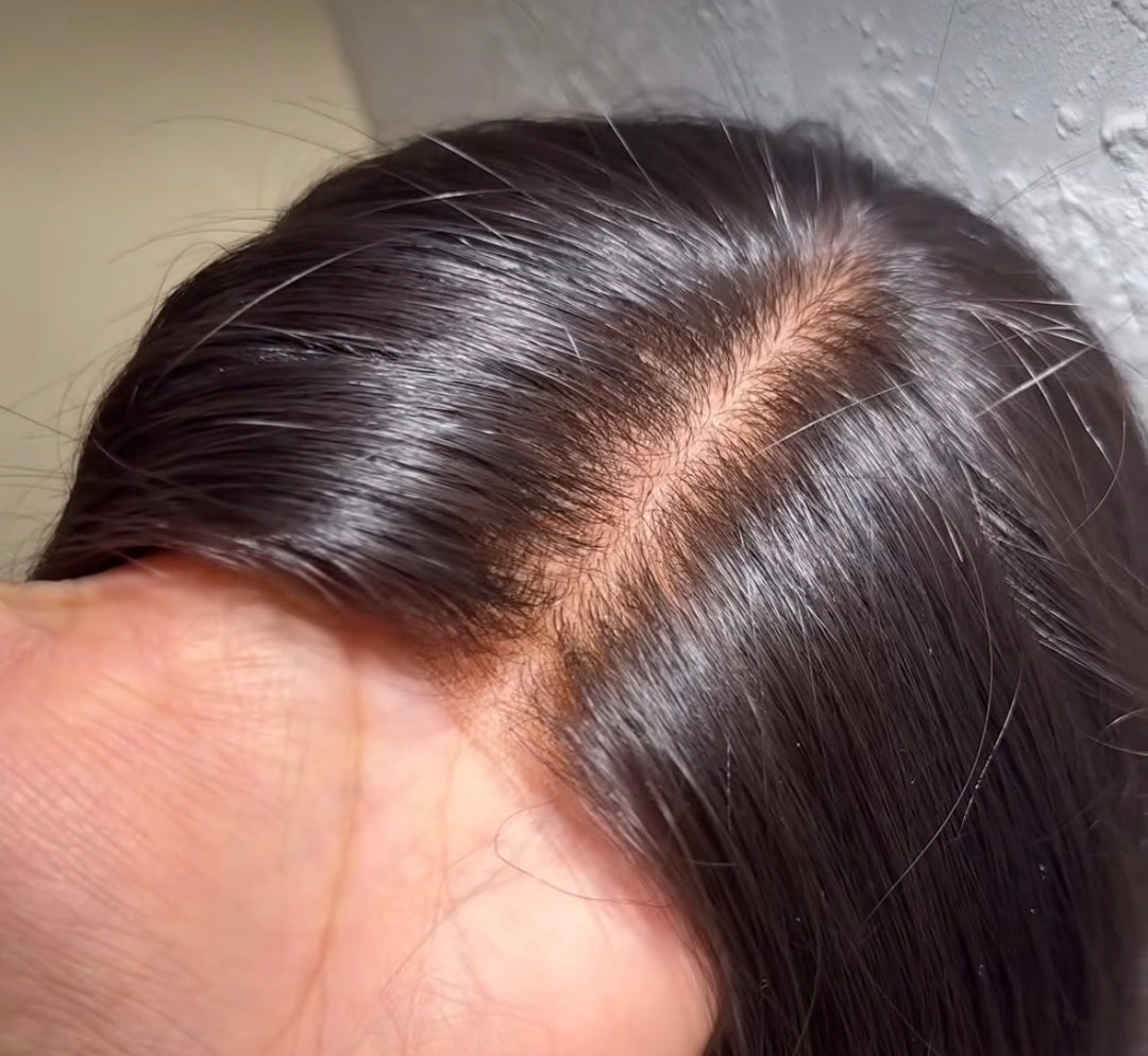 Receding Hairline Hybrid Topper : Straight