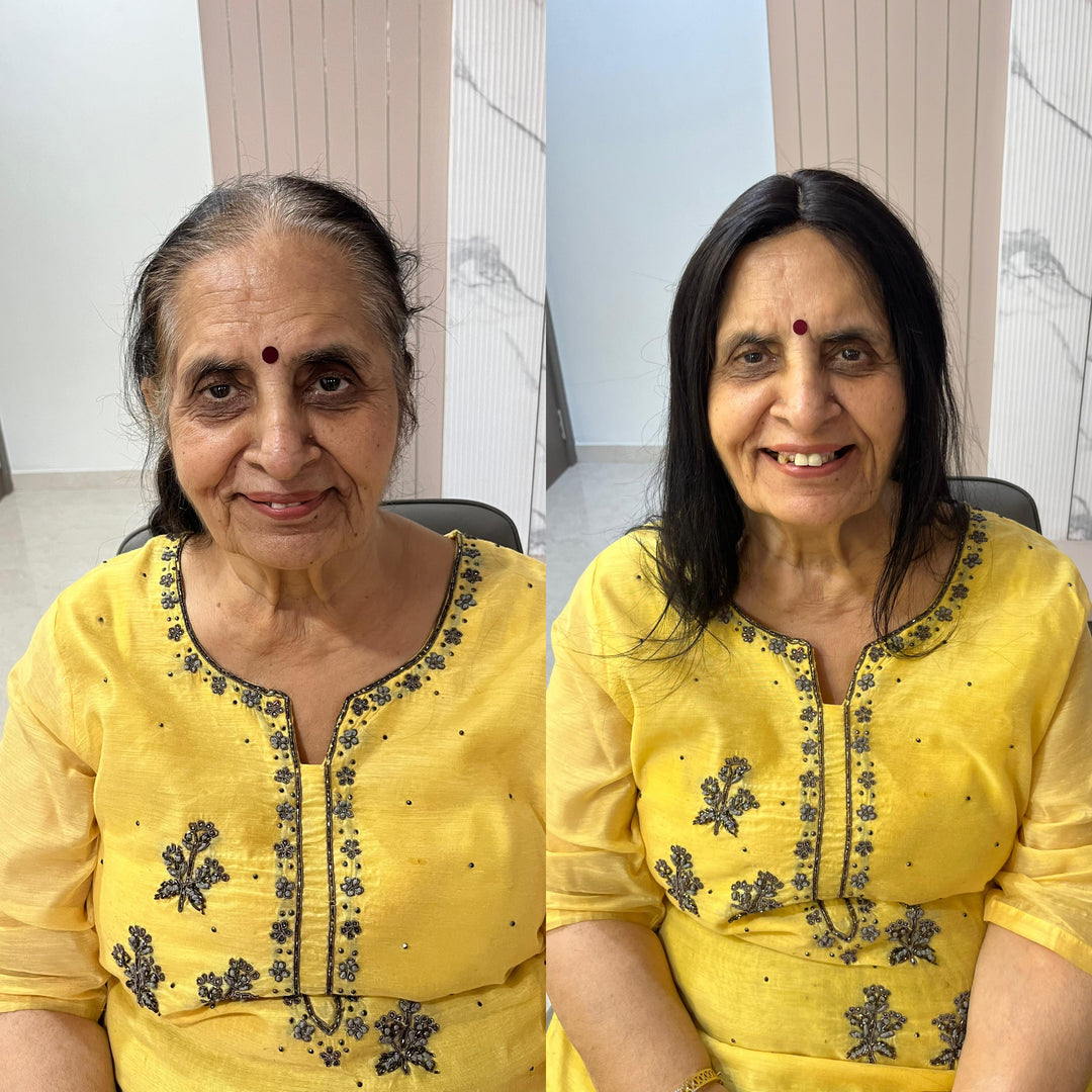 Receding Hairline Topper