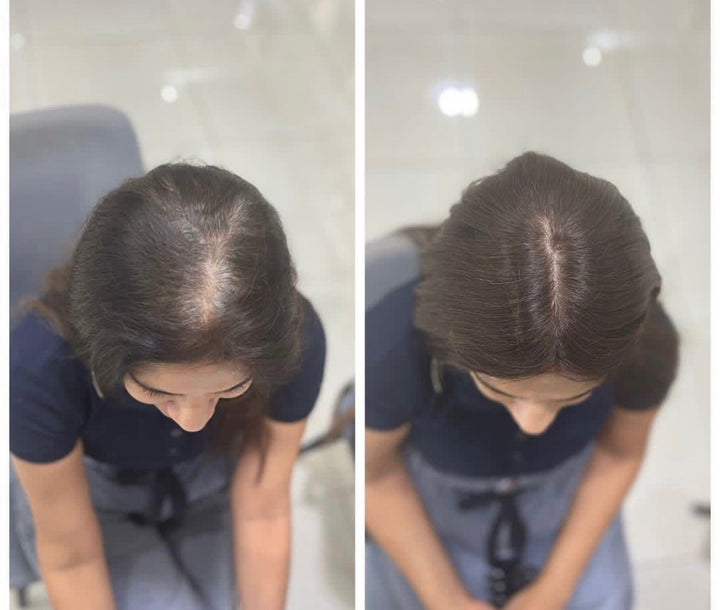 Side-by-side comparison of a woman's scalp with hair before and after wearing a 2 x 3 Silk Hair Topper.