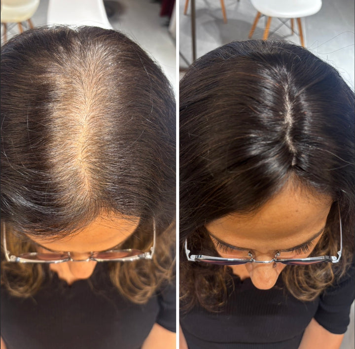 Front Coverage : Clipless Hair Topper
