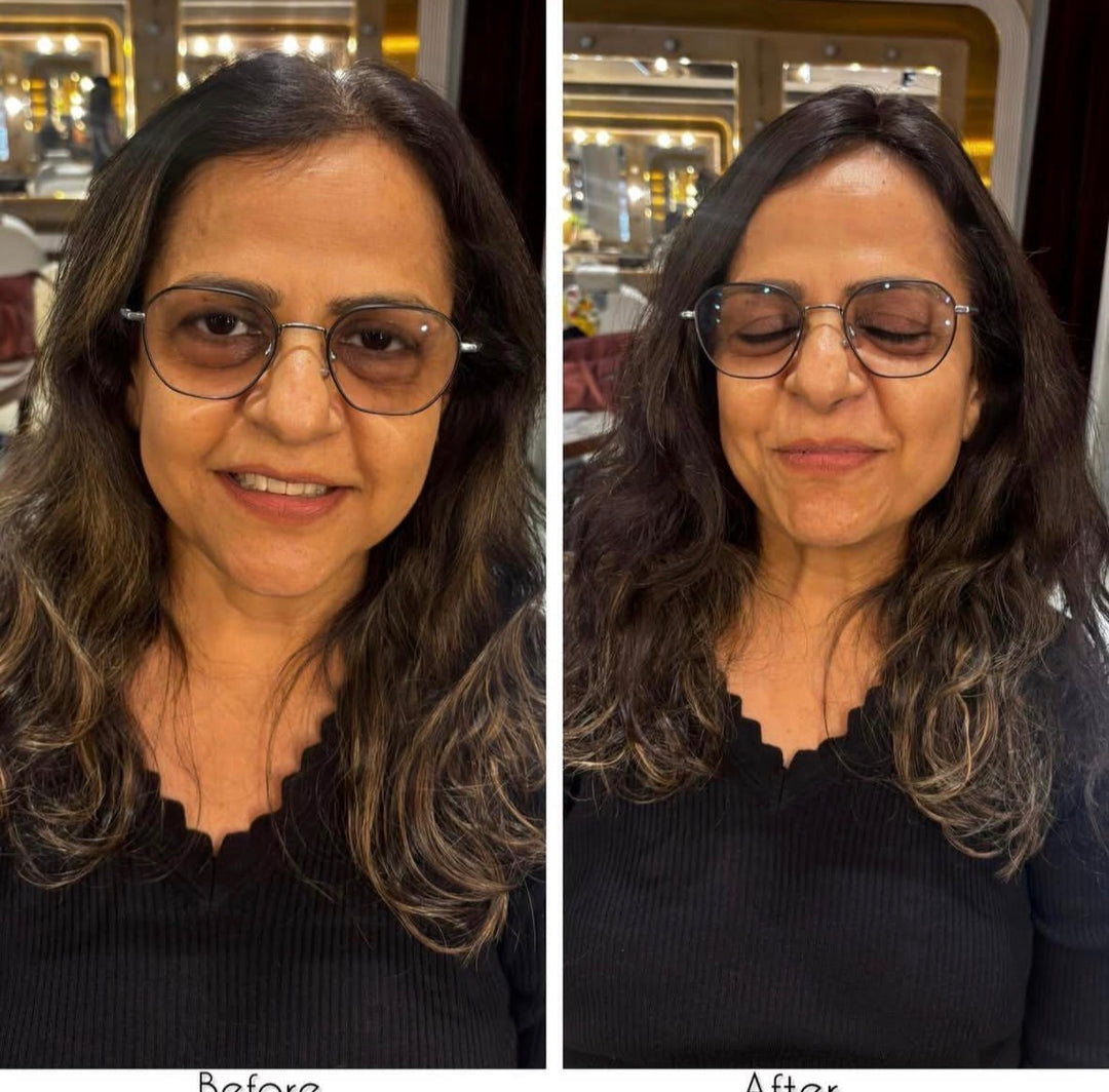 Before and after comparison of a woman wearing a 2 X 3 Silk Hair Topper.