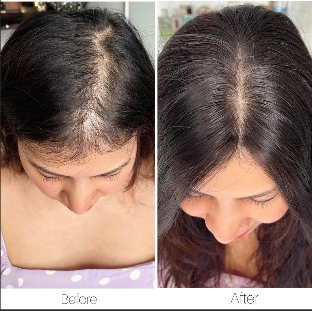 Wide Parting : Clipless Hair Topper