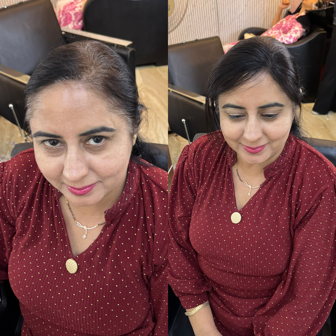 Front Hairline Topper