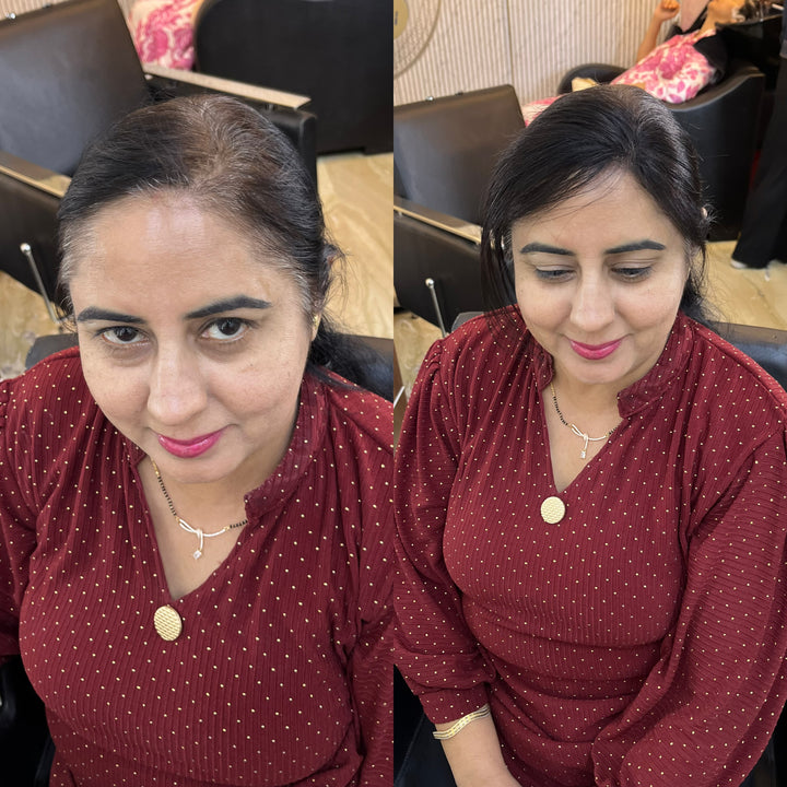 Front Hairline Topper