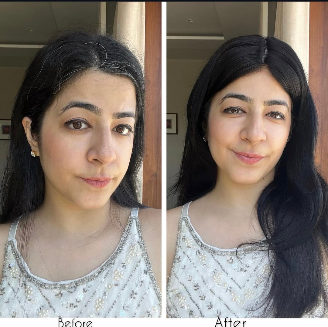 Receding Hairline Hybrid Topper - Straight