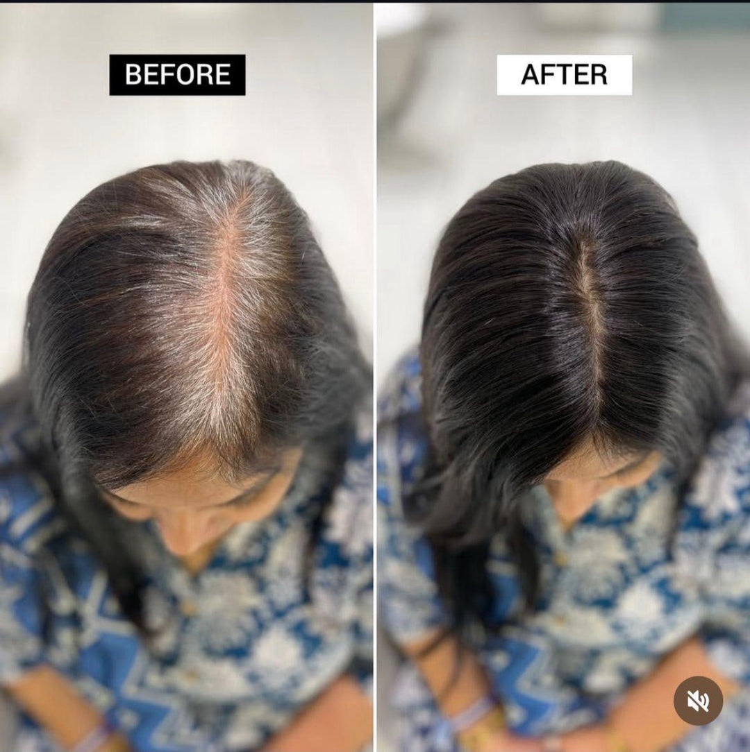 Before and after comparison of Grey Root Cover with 2 X 5 Silk Hair Topper.