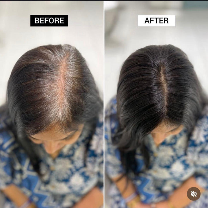 Before and after comparison of Grey Root Cover with 2 X 5 Silk Hair Topper.