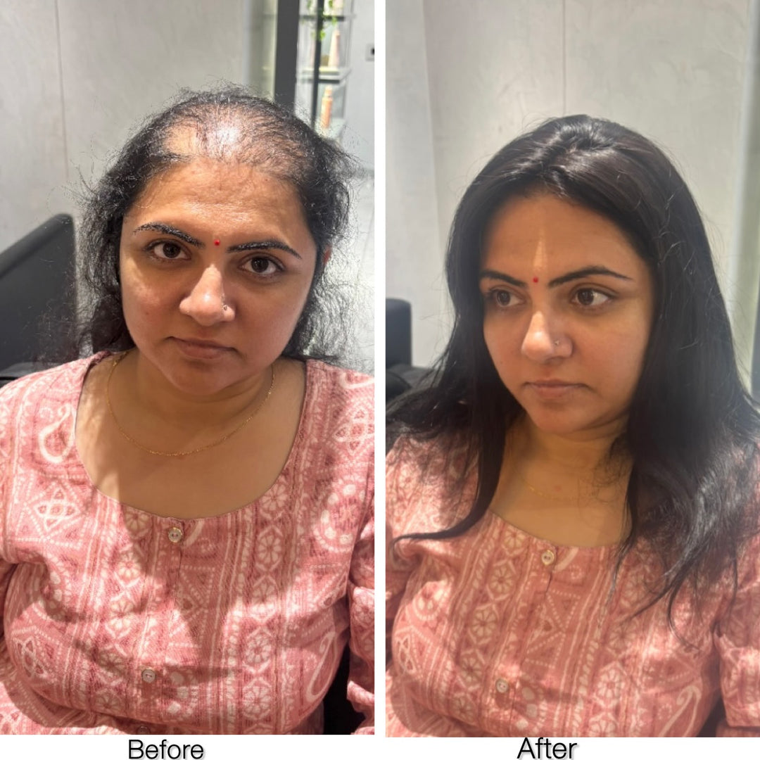 5 X 5" Clipless Topper