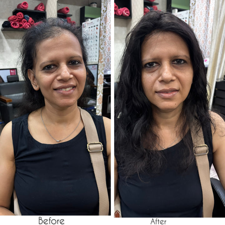 Receding Hairline Hybrid Topper - Curly