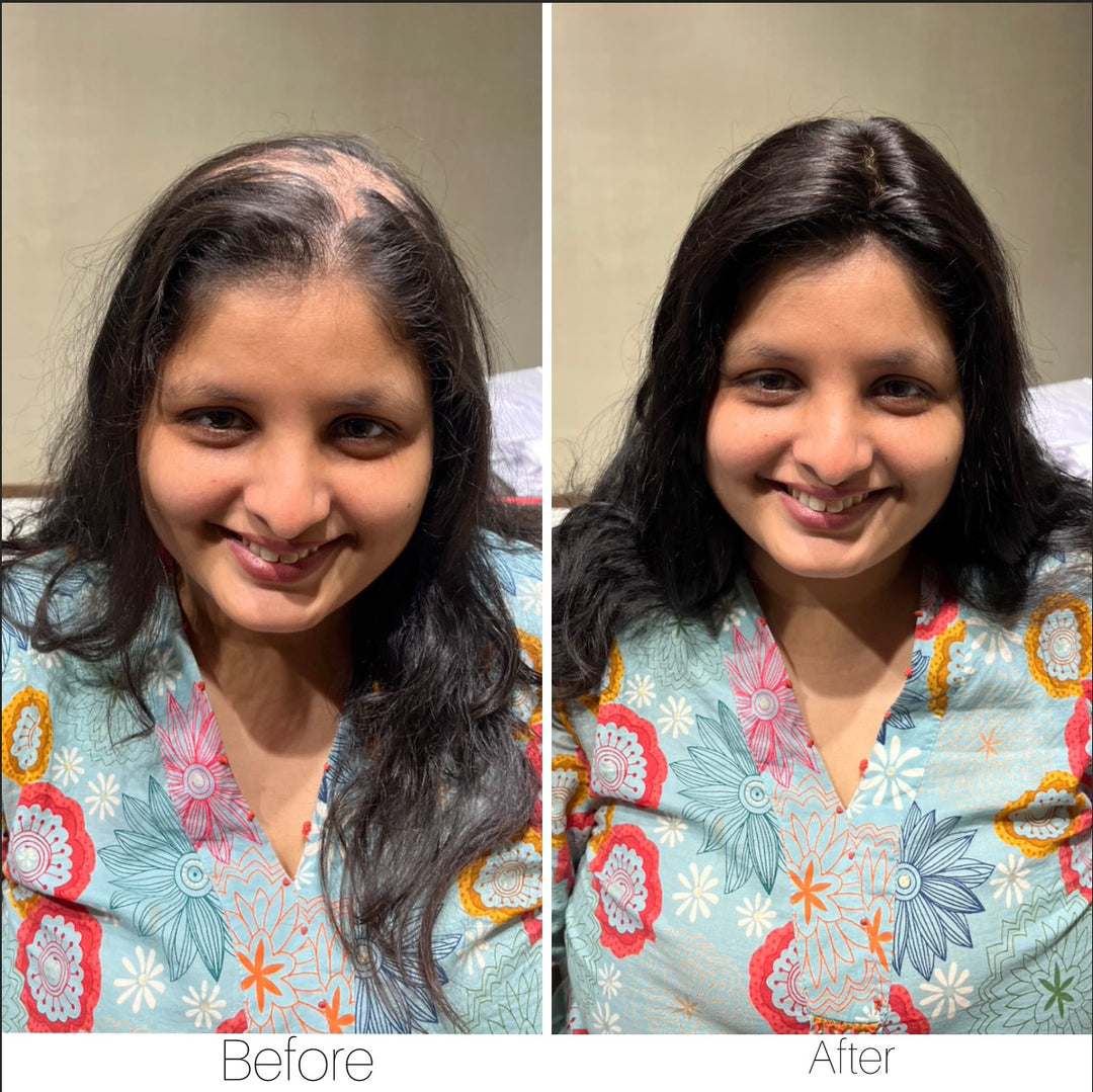 Overall Volume : 3 X 5 Silk Hair Topper