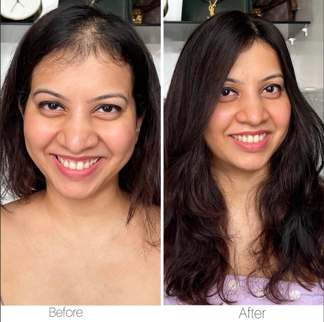 Scalp Line : 2 X 5 Silk Hair Topper
