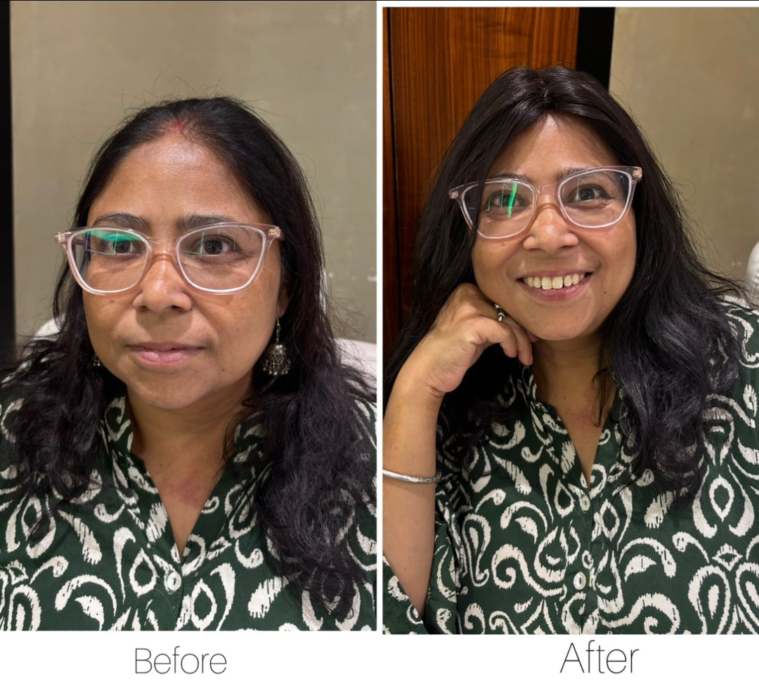 Before and after comparison of a woman wearing a 2 X 3 Silk Hair Topper.