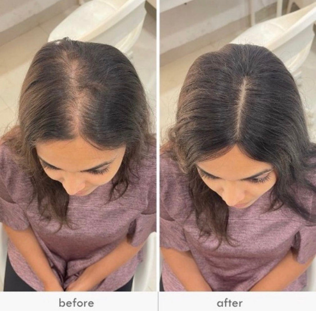 2 X 5" Clipless Topper