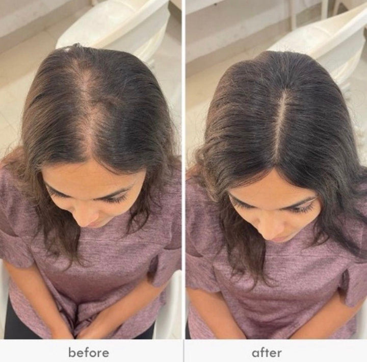 2 X 5" Clipless Topper