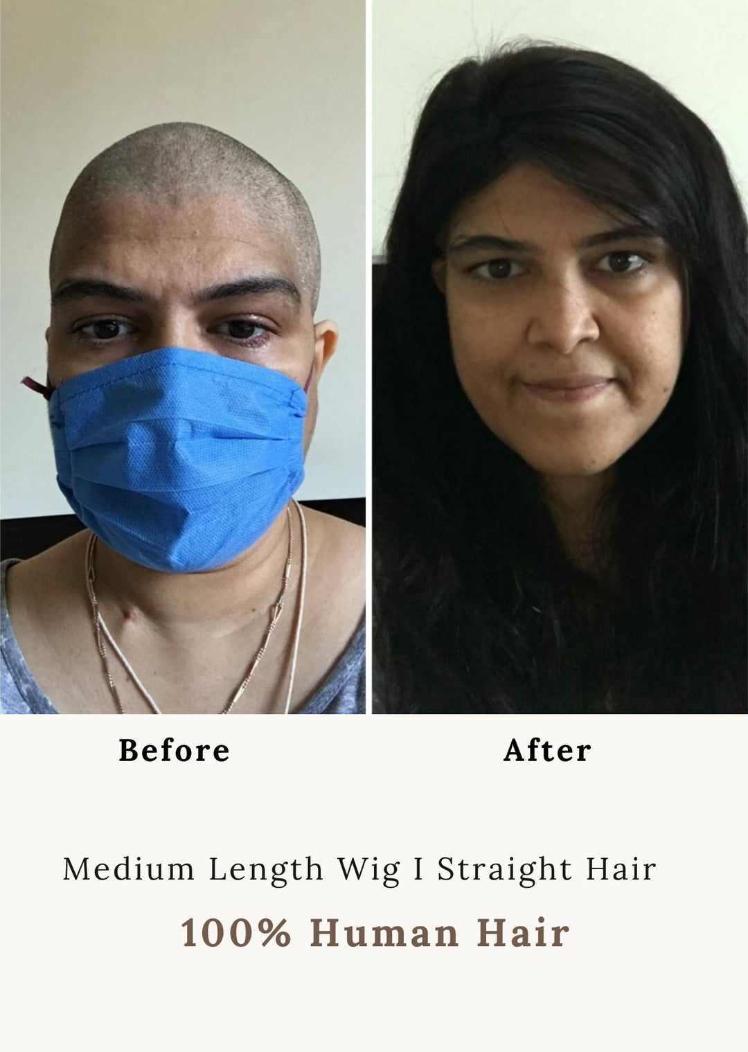 Customer Before and after using a medium-length full-head human Hair Wig