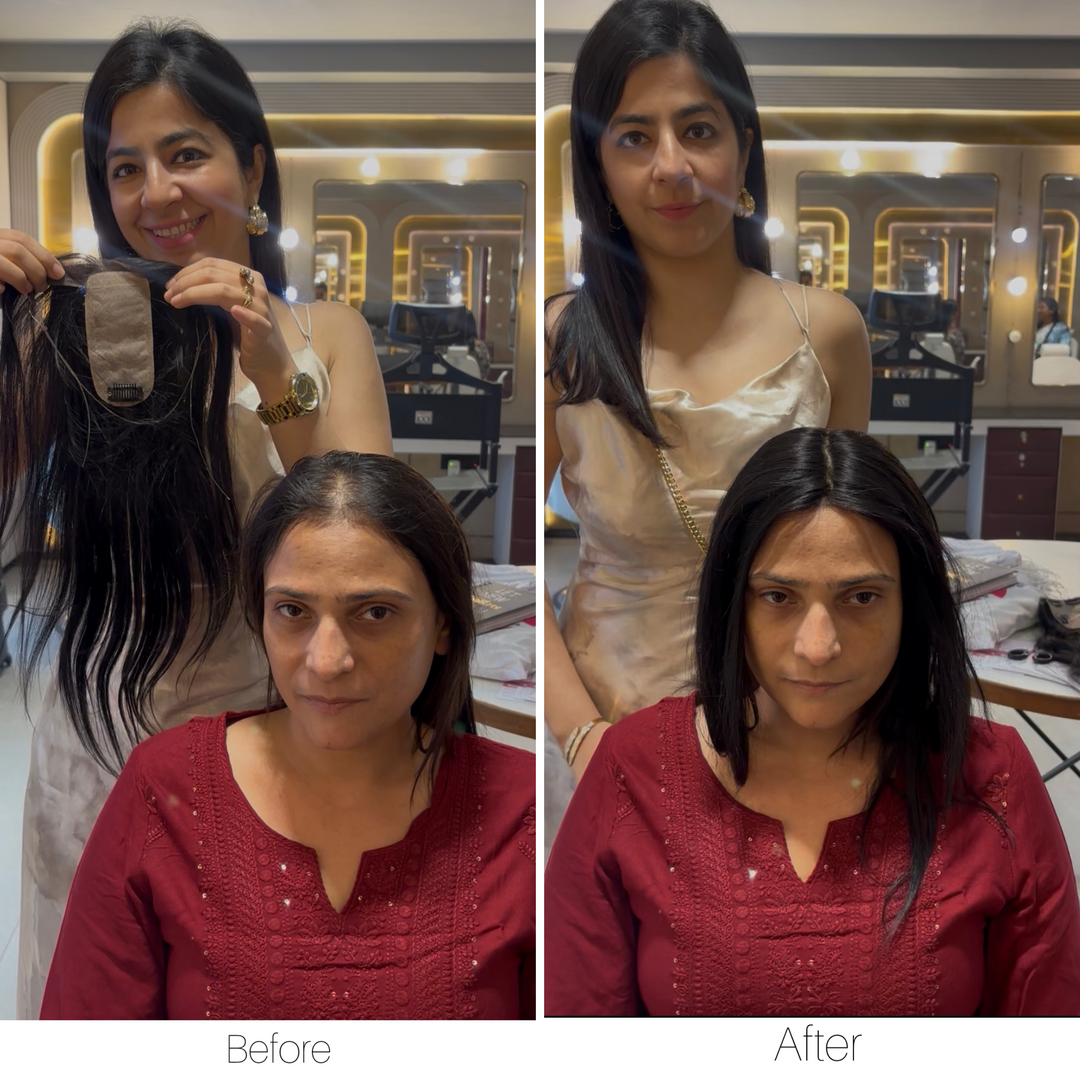 Receding Hairline Hybrid Topper - Straight
