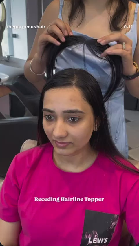 Front Hairline Topper