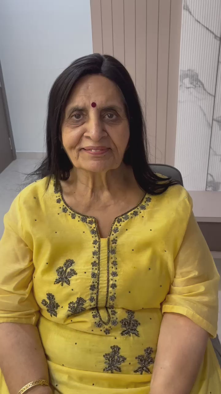 Receding Hairline Topper