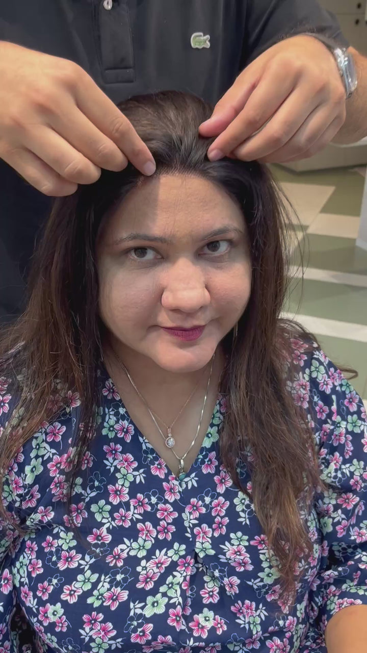 Receding Hairline Band